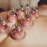 Physique-Studio-cupping